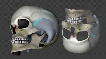 3D skull model on a gray background