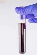 blood in beaker
