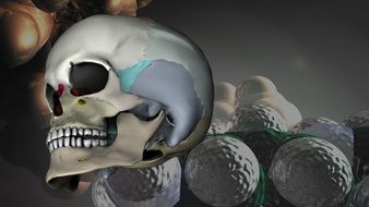 3d model of a skull