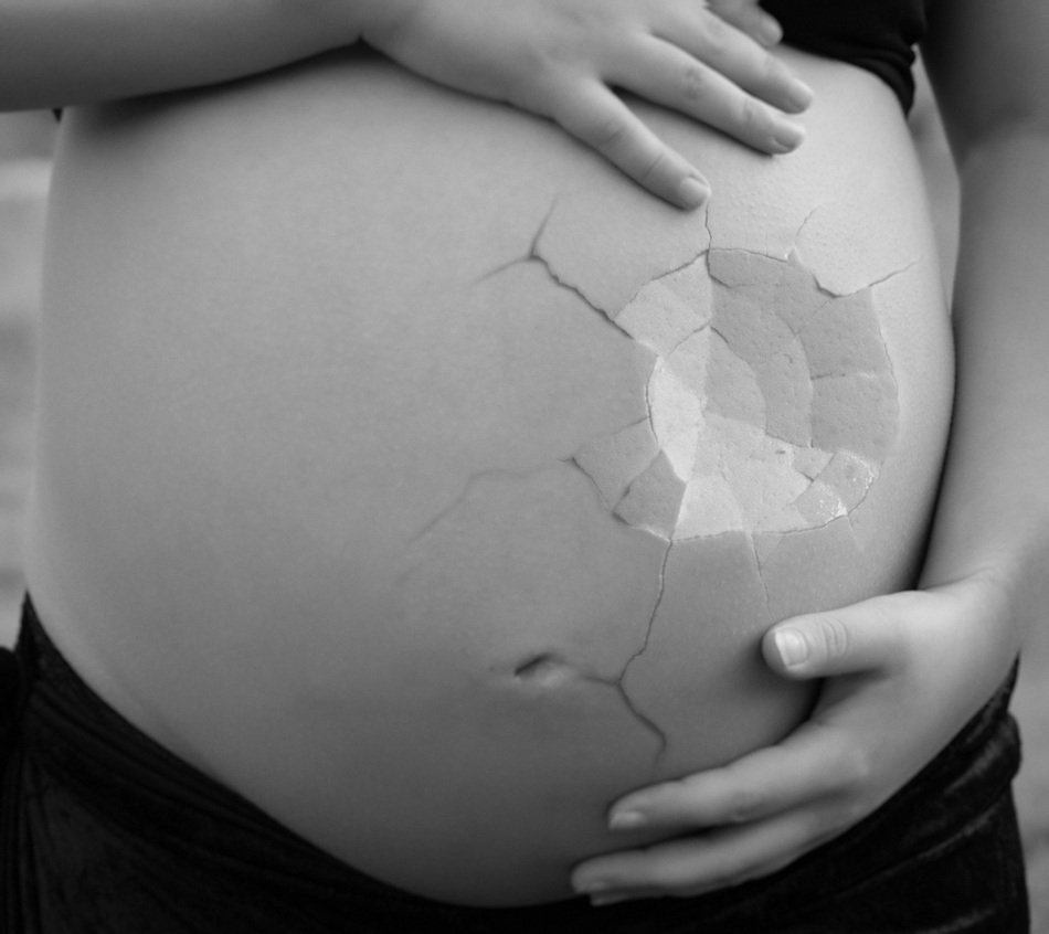 Picture of Pregnant Girl with crashed stomach