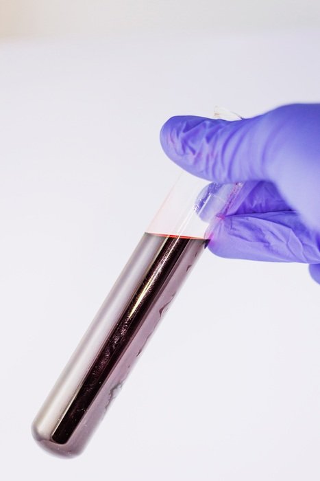 blood for test