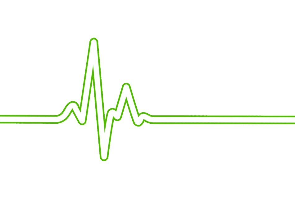 green ecg waves