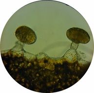 Microscope image of oil glands loosestrife