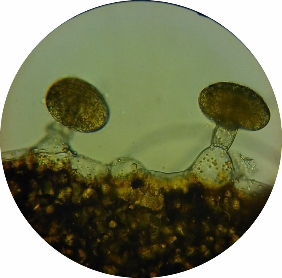 Microscope image of oil glands loosestrife