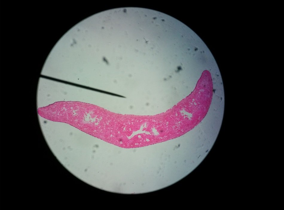 microorganism through a microscope