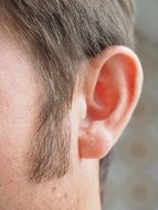 photo of whiskers on a manâs face