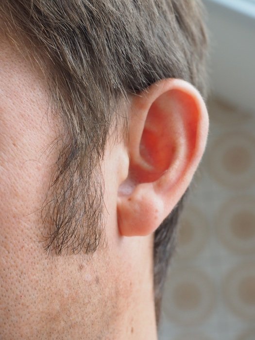 male whiskers