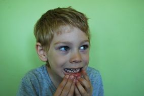 child with straight white teeth