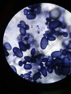 blue amyloplasts under the microscope