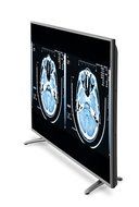 Schultz VividEdge 4K Smart 55" LED TV (2017 Edition) N5