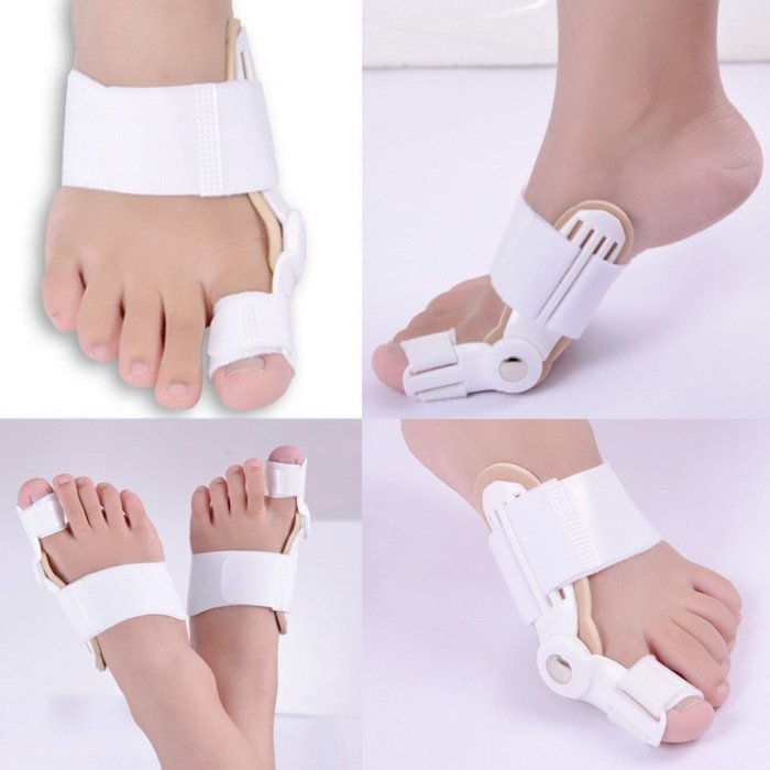 Comprehensive Bunion Corrector & Bunion Relief BunionPal kit-2 Piece Hallux Valgus & Bunion Pads, Toe Spacers,... N6