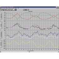 06510X Extra User License Kit, WeatherLink for Vantage