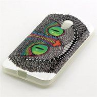 Xperia Z3 Case, Firefish [Shock Absorbent] [Slim Fit] [Anti Slip] Design Clear TPU Gel Silicone Soft Protective... N85