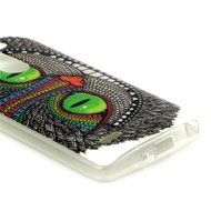 Xperia Z3 Case, Firefish [Shock Absorbent] [Slim Fit] [Anti Slip] Design Clear TPU Gel Silicone Soft Protective... N140