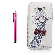 J7 Case, Firefish Colorful Pattern TPU Durable Soft TPU Back [Soft-Flex] [Shock Absorption Technology] Case for... N34