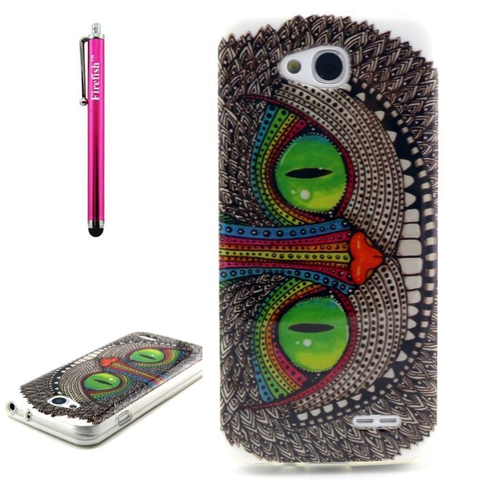 Xperia Z3 Case, Firefish [Shock Absorbent] [Slim Fit] [Anti Slip] Design Clear TPU Gel Silicone Soft Protective... N55