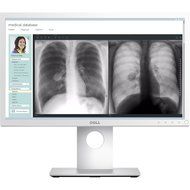 Dell MR2217 MEDICAL REVIEW 22IN MONITOR