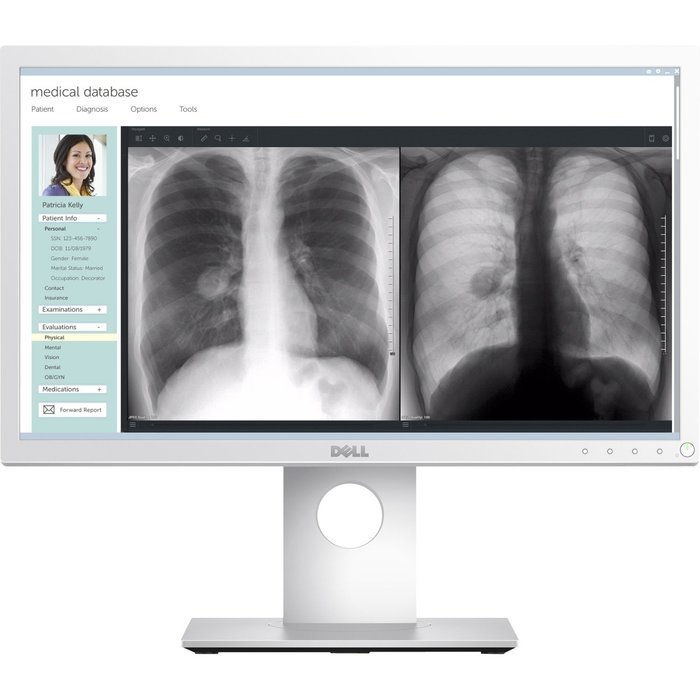 Dell MR2217 MEDICAL REVIEW 22IN MONITOR