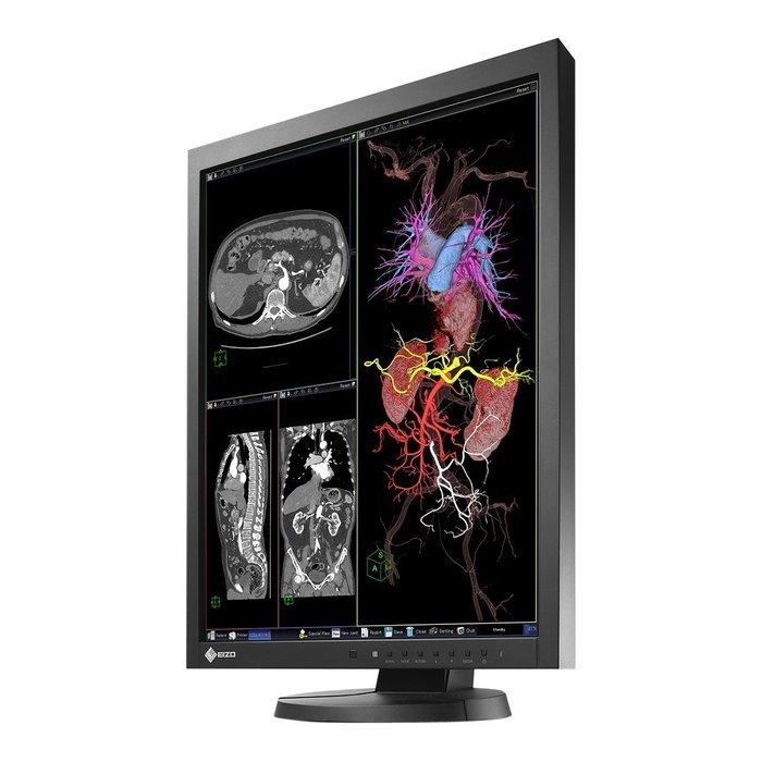 EIZO MX215-BK RadiForce 21.3'' LED-Backlit LCD Monitor, Black