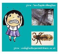 3x HEAD LICE DOUBLE SIDED FINE TOOTH HAIR COMB NITS FLEAS DUST EGGS REMOVER BNIP N3