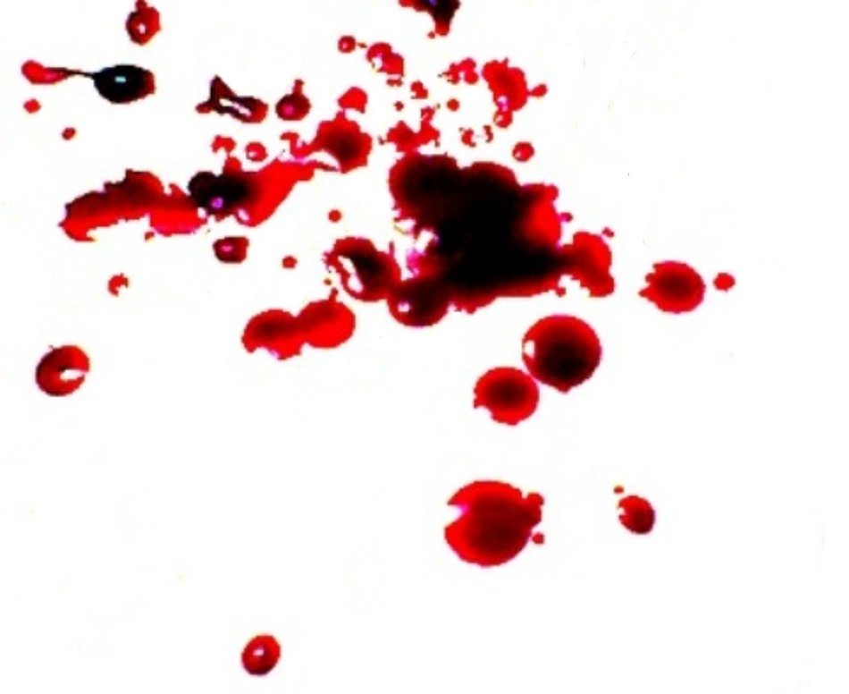 blood drops on the white background