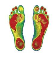Weight Bearing Feet, Screening