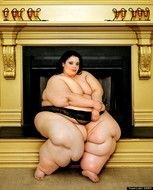 Obese Woman