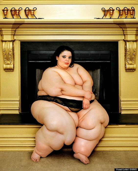 Obese Woman