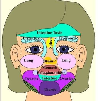 Face Mapping Acne