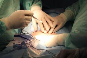 hands of the Surgeons on operation