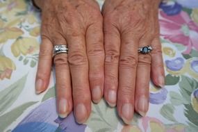 hands of aged woman jewellery finger ring