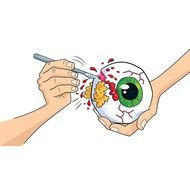 Eye Ball Dissection drawing