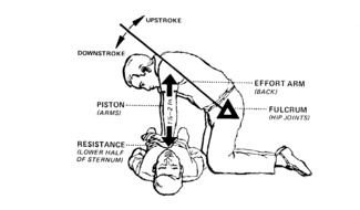 picture of artificial respiration