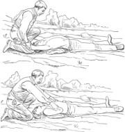 artificial respiration example