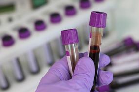 two blood tubes in a laboratory