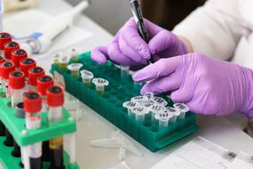nurse makes samples in the laboratory