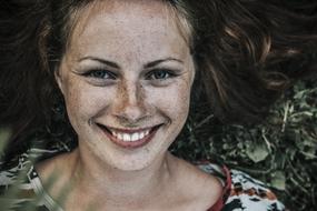 Beautiful Freckles on Girl face