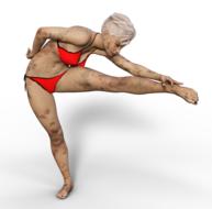 bruised gymnast posing in red bikini