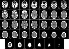 Different, black and white computer tomography x rays