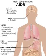 human body aids symptoms