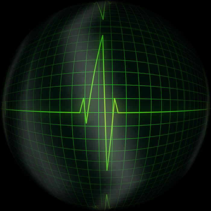wave in cardiogram
