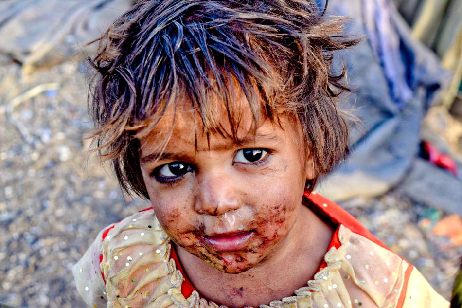 Slums India face