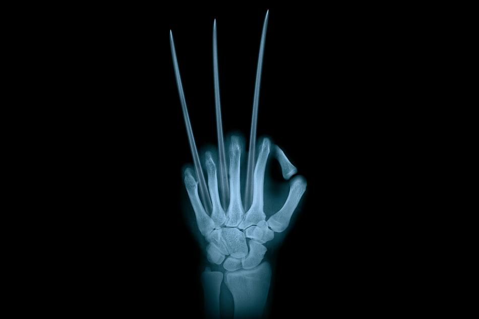the hands of the adamantium Wolverine