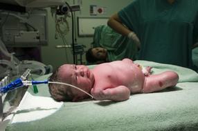 newborn Baby Birth in hospital