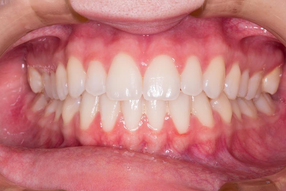 white-toothed smile close-up