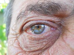 Eye Blue Gene