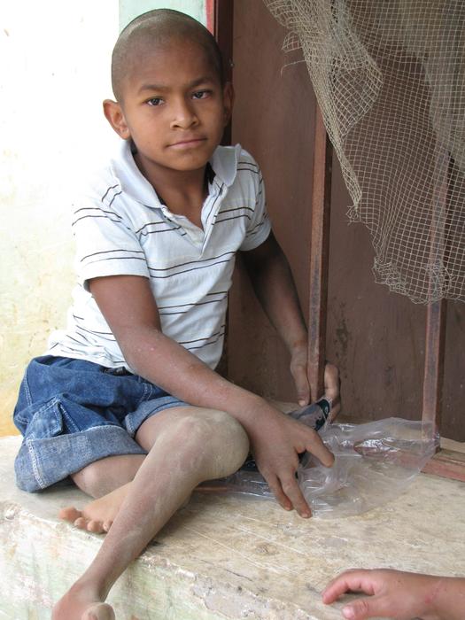 Disabled Poor Honduras Latin