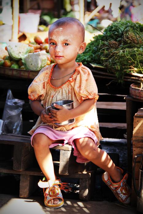 Portrait of a child without hair free image download