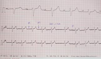 electrocardiogram with notes