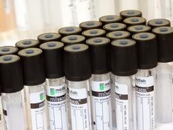 Tubes Vacuum Laboratory